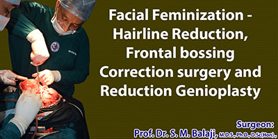 Facial Feminization Hairline Reduction Frontal Bossing Correction Surgery And Reduction Genioplasty