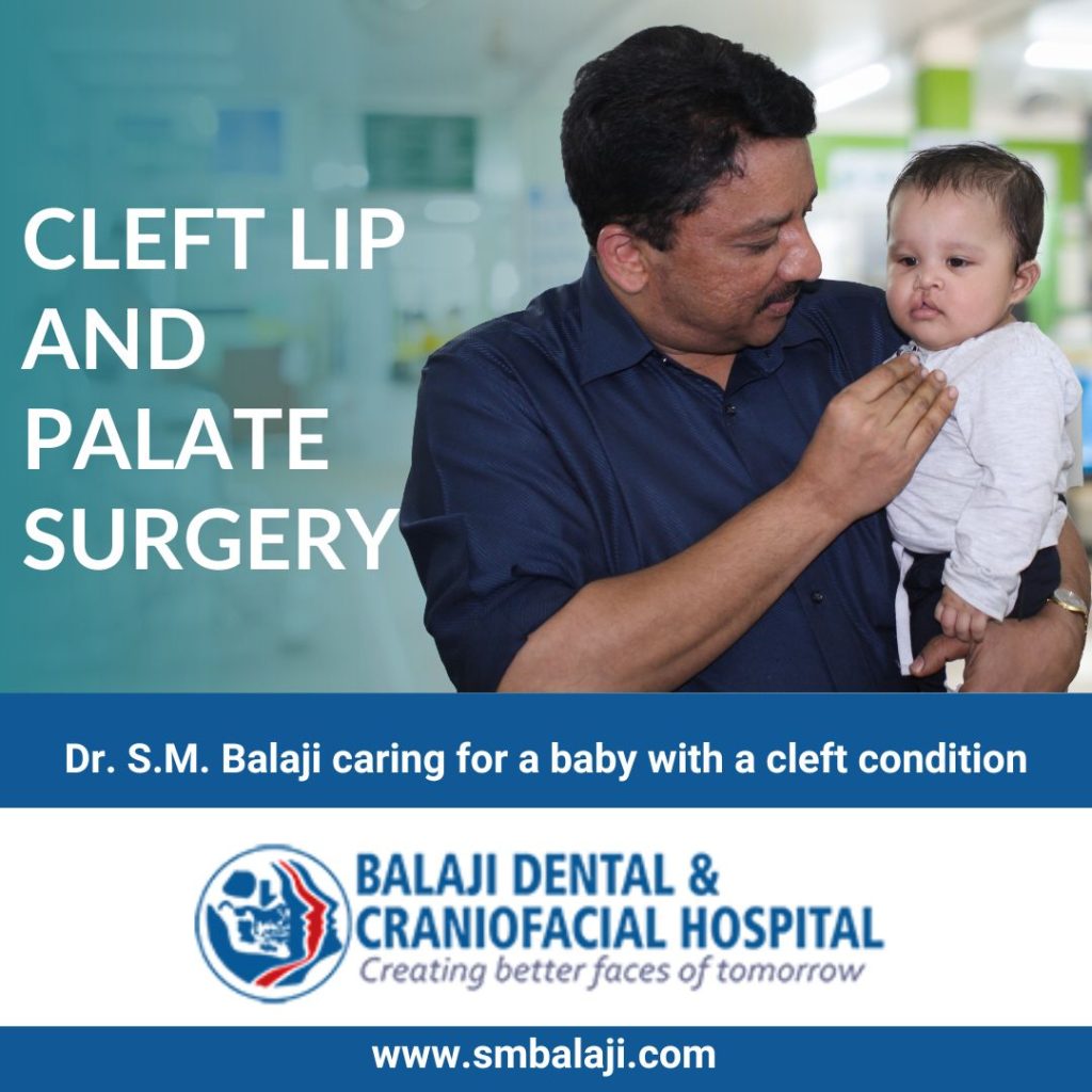 Cleft Lip And Palate Surgery