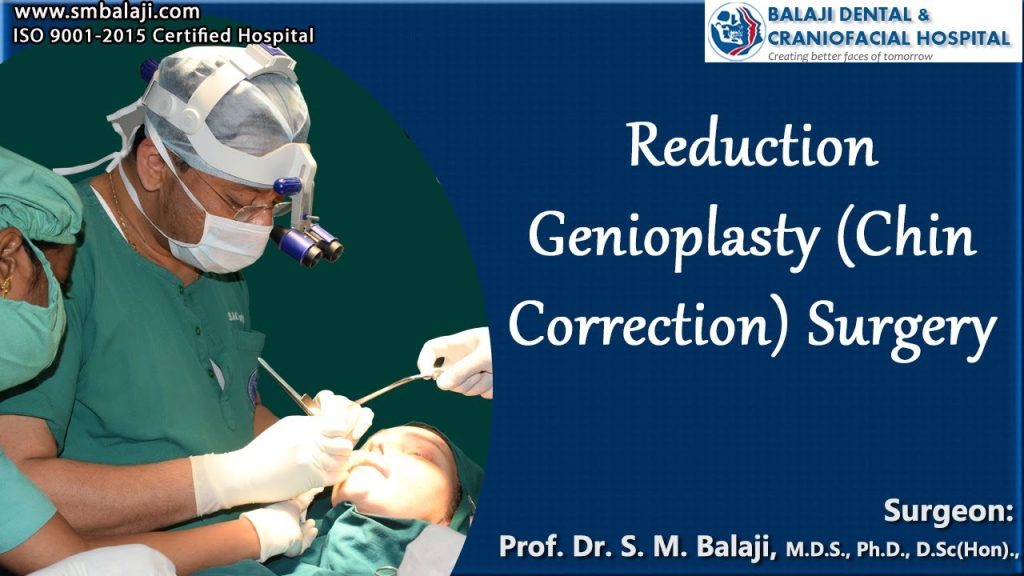 Reduction Genioplasty