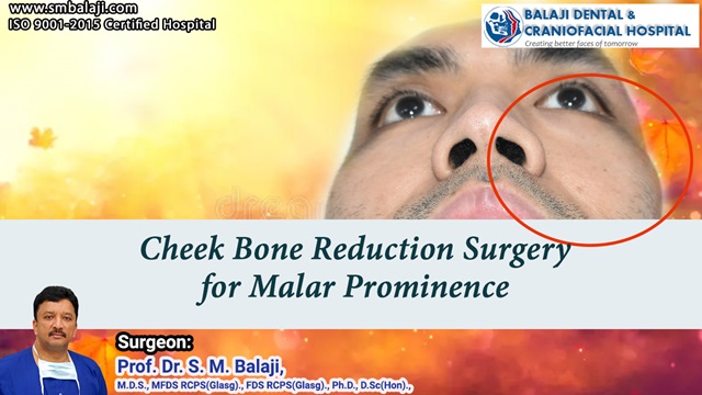 Cheek Bone Reduction Surgery in India