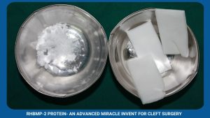 Rhbmp-2 Protein- An Advanced Miracle Invent For Cleft Surgery