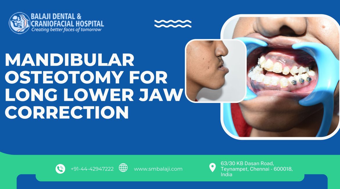 Mandibular Osteotomy For Long Lower Jaw Correction
