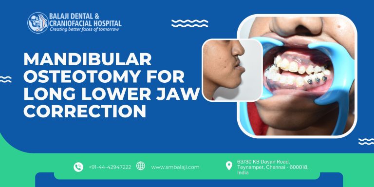 Mandibular Osteotomy for Long Lower Jaw Correction