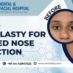 Closed Rhinoplasty For Crooked Nose Correction