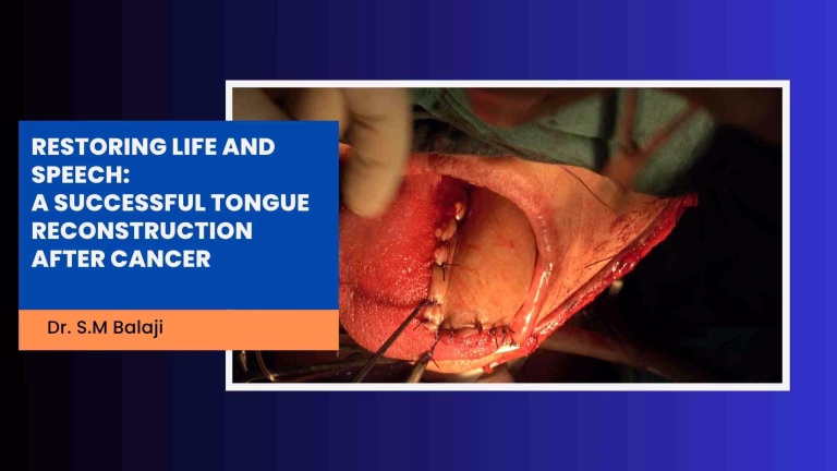 Tongue Cancer Surgery